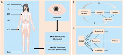 Causal association between common rheumatic diseases and glaucoma: a Mendelian randomization study